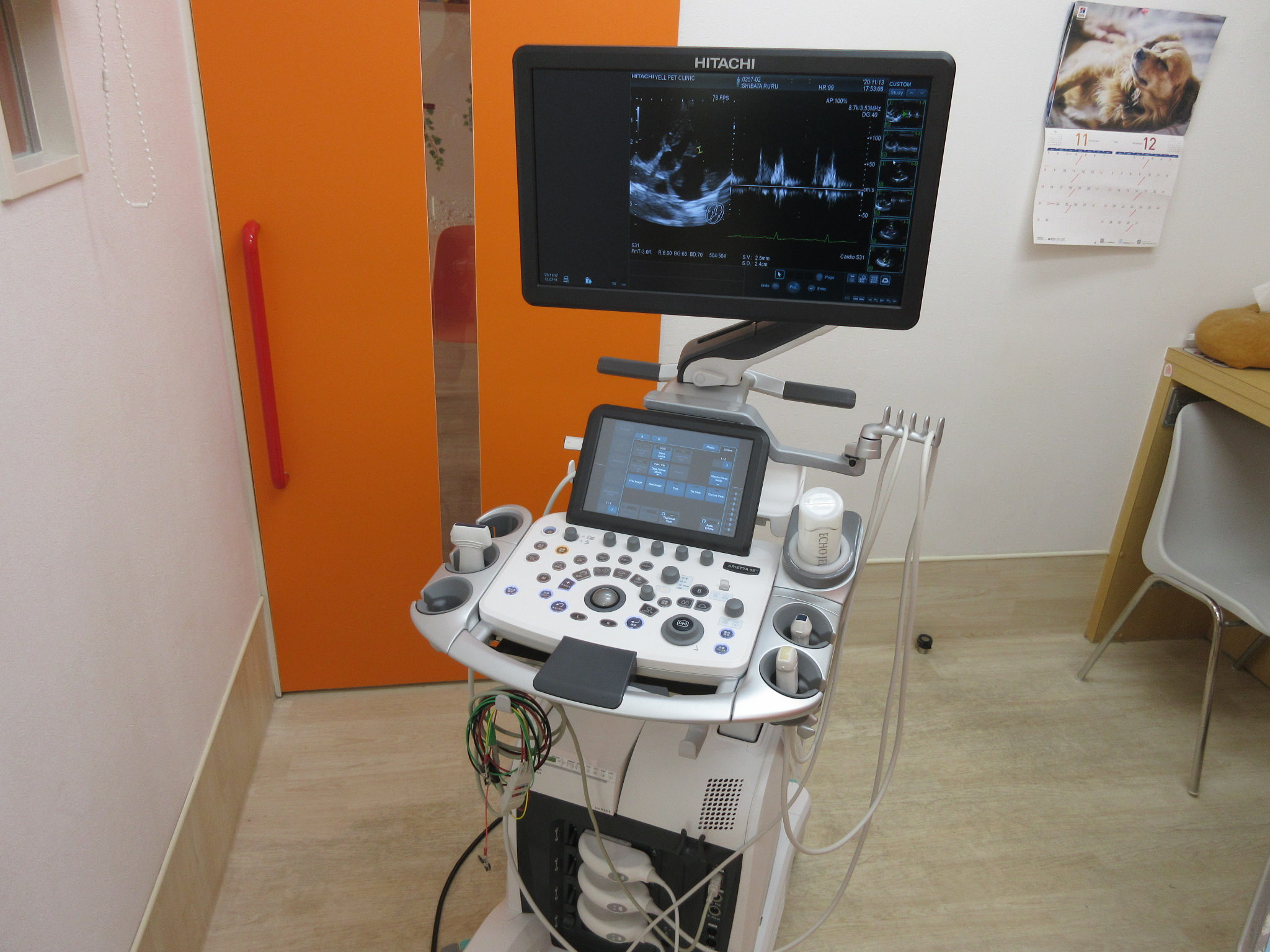 超音波診断装置　ARIETTA65V